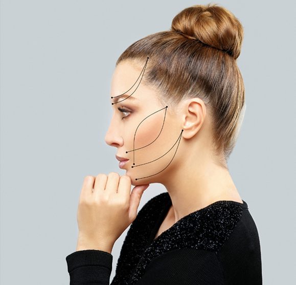 TYPES OF THE FACELIFT TYPES OF THE FACELIFT