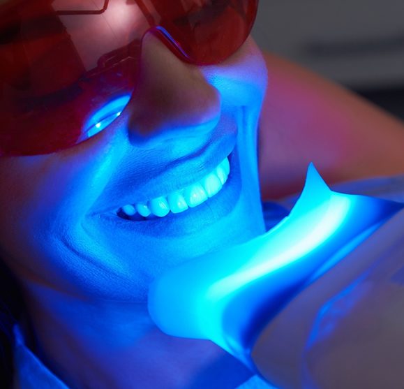 Teeth Whitening - twthealth. com
