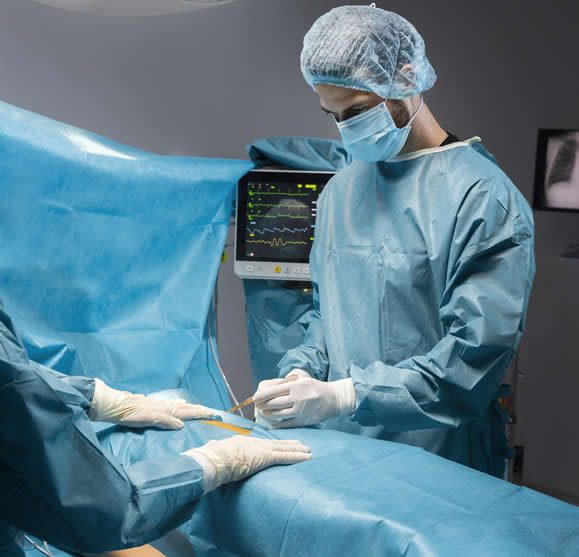 (WHY BYPASS SURGERY)