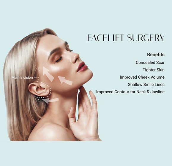 WHY CHOOSE A FACELIFT WHY CHOOSE A FACELIFT